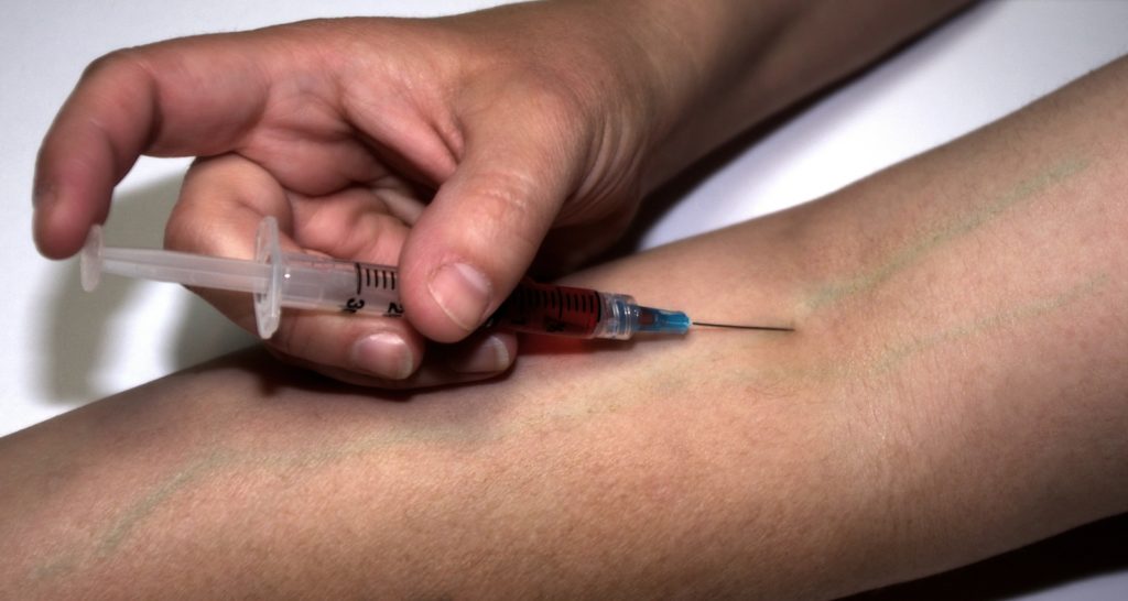 Injecting Steroid
