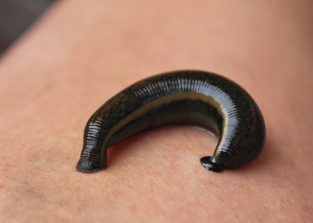 medicinal leech therapy